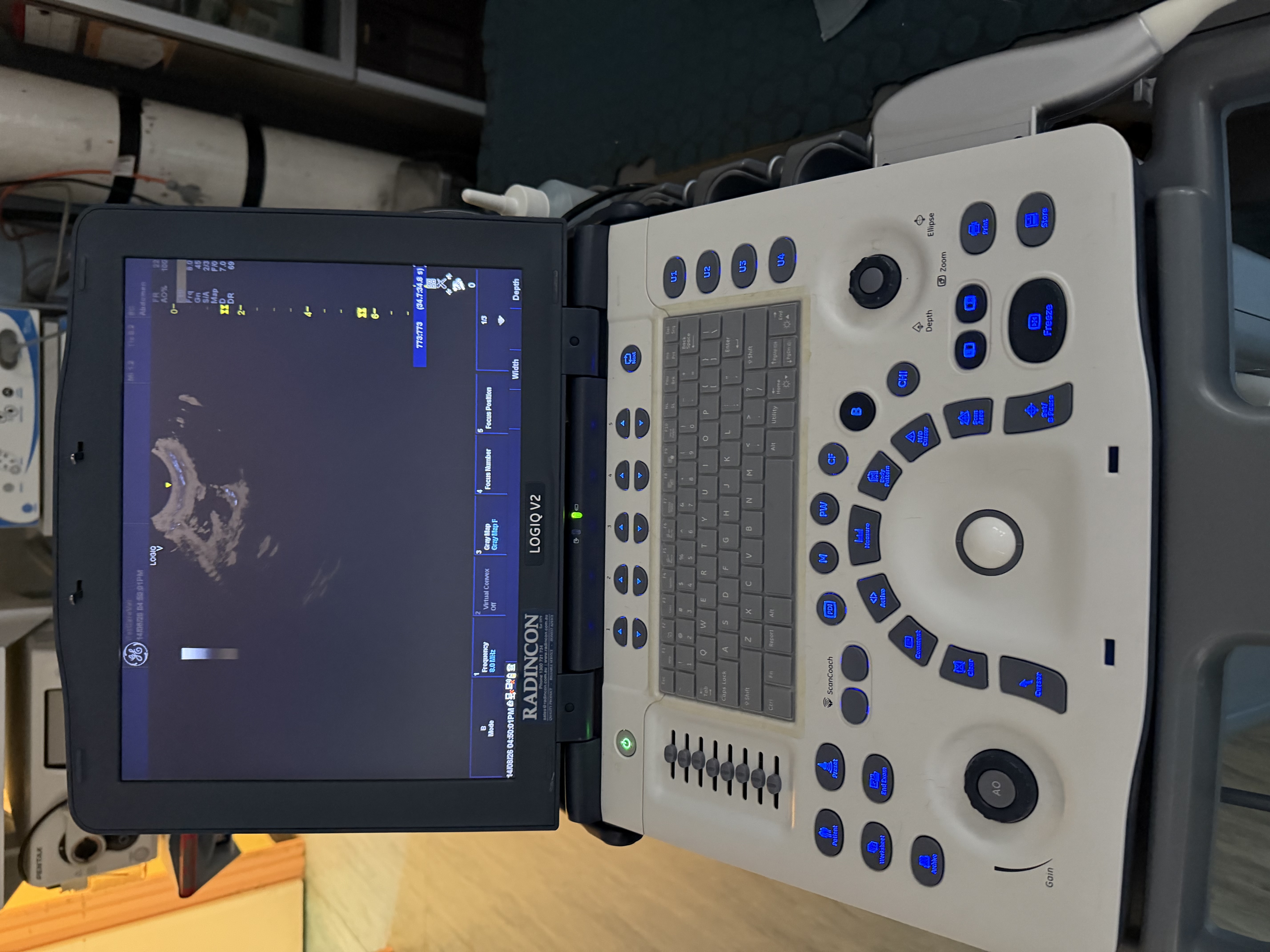GE LOGIQ V2 ultrasound system used at PETCAREVET-X for diagnostic imaging.